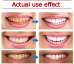 Yayashi SP-4 Ultra Whitening Toothpaste Probiotic Stain Remover for Brighter Teeth & Fresh Breath - Image 5
