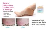 Silicone Anti Crack Heel Protectors Socks Set | Orthopedic Gel Heel Pads for Cracked Heels, Pain Relief & Moisturizing Support (1 Pair) - Image 3