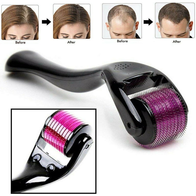 Derma Roller 0.5mm with 540 Titanium Microneedles | Microneedling Roller for Hair Growth, Acne Scars, Skin Rejuvenation & Beard Care