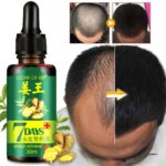 7 Day Ginger Germinal Oil Hair Nutrient Solution – Hair Growth Essence Liquid 30ml Fast Natural Hair Loss Treatment - Image 3
