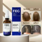 FEG Plus Hair Growth Spray 50ml - Stimulate Follicles & Stop Hair Fall | Formula for Thicker, Stronger, Healthier Hair - Image 3