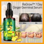7 Day Ginger Germinal Oil Hair Nutrient Solution – Hair Growth Essence Liquid 30ml Fast Natural Hair Loss Treatment - Image 2