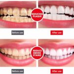 Yayashi SP-4 Ultra Whitening Toothpaste | Probiotic Stain Remover Toothpaste for Fresh Breath & Gum Care - Image 3