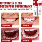 Yayashi SP-4 Ultra Whitening Toothpaste | Probiotic Stain Remover Toothpaste for Fresh Breath & Gum Care - Image 4