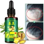 7 Day Ginger Germinal Oil Hair Nutrient Solution – Hair Growth Essence Liquid 30ml Fast Natural Hair Loss Treatment