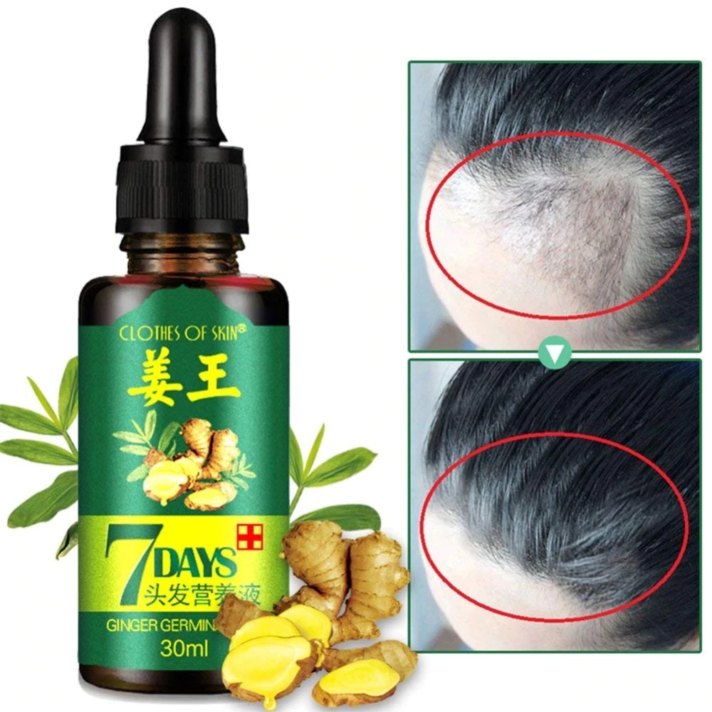 7 Day Ginger Germinal Oil Hair Nutrient Solution – Hair Growth Essence Liquid 30ml Fast Natural Hair Loss Treatment