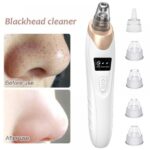 Electric Suction Blackhead Remover Instrument, 3 Level Pore Vacuum Cleaner, 5 Probe Blackhead Extractor Tool, USB Rechargeable Facial Pore Cleaning Beauty Device