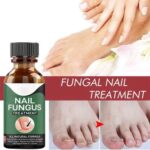 Fast Nail Fungal Treatments Nail Repair Essences Serum Care Treatments – Foot Nail Fungus Removal Gel for Paronychia & Onychomycosis