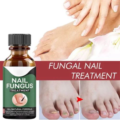 Fast Nail Fungal Treatments Nail Repair Essences Serum Care Treatments – Foot Nail Fungus Removal Gel for Paronychia & Onychomycosis
