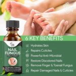 Fast Nail Fungal Treatments Nail Repair Essences Serum Care Treatments – Foot Nail Fungus Removal Gel for Paronychia & Onychomycosis - Image 2