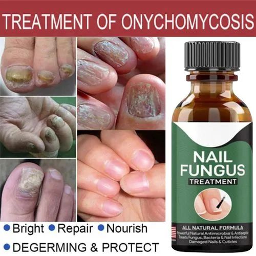 Fast Nail Repair Serum for Damaged & Discolored Nails | Nail Care Essence for Healthy Looking Fingernails & Toenails