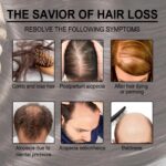 30ml Rosemary Hair Care Essential Oil Anti Hair Loss Growth Nourishing Scalp Treatment - Image 4