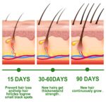 30ml Rosemary Hair Care Essential Oil Anti Hair Loss Growth Nourishing Scalp Treatment - Image 3