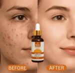 Relax Vitamin C Daily Serum 30ml Brightening & Anti-Aging Face Serum for Radiant, Even-Toned Skin - Image 2