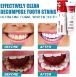 Yayashi SP-4 Ultra Whitening Toothpaste Probiotic Stain Remover for Brighter Teeth & Fresh Breath - Image 4