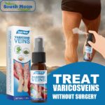 30ml Varicose Veins Treatment Spray – Varicose Vein Treatment Cream, Varicocele Relief, Pain Relief & Leg Vein Health Care Spray